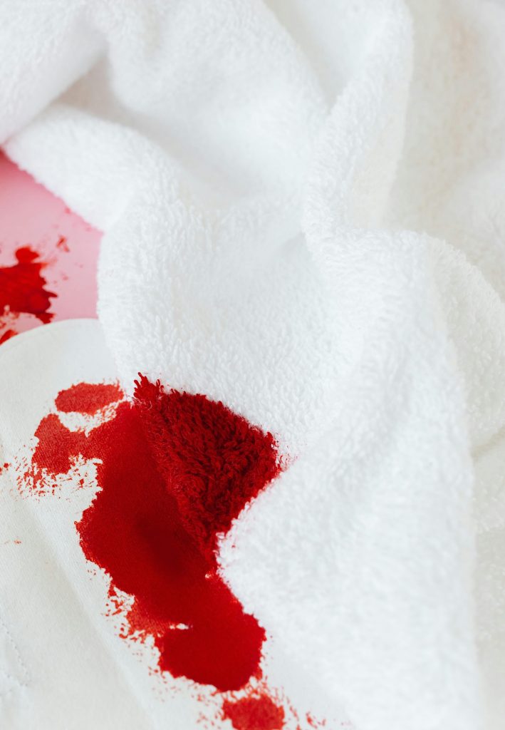Is It Normal to Bleed After Sex? 7 Eye-Opening Reasons Explained Health Betes Bleed After Sex